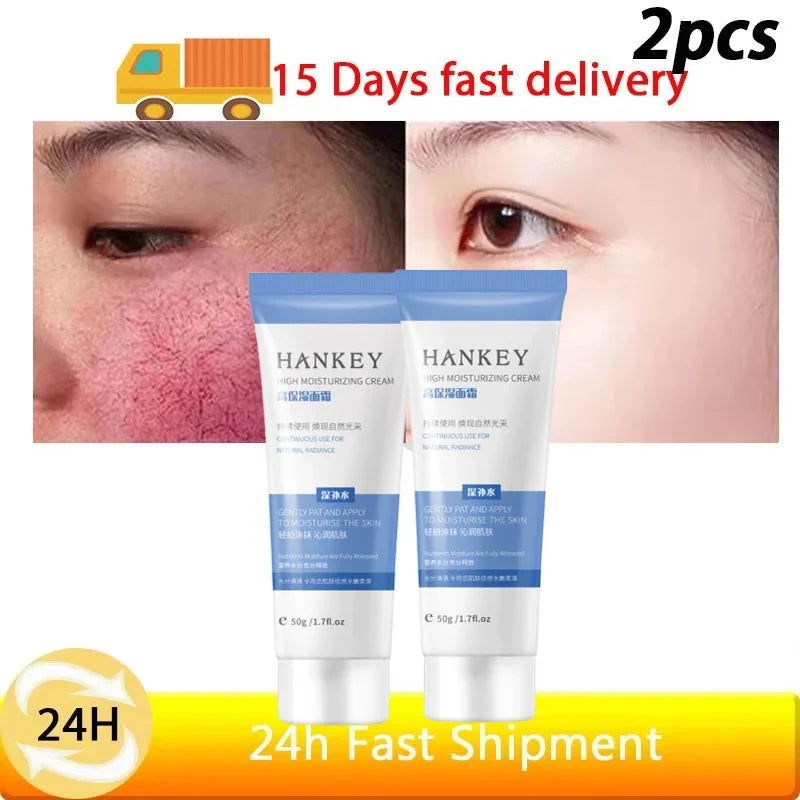 Facial Redness Repair Cream Improve Sensitive Skin Dryness Moisturizer Hydrating Sooth Lotion Removal Rosacea Korean Cosmetics