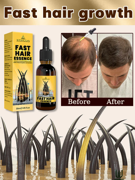 hair growth oil, Repair baldness, hairline, seborrheic alopecia hair care  fast shipping  hair oil
