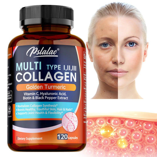 Multi Collagen Peptides Capsules - Supports Skin, Hair, Joint Health, Promote Collagen Production, Delay Aging,Enhances Immunity