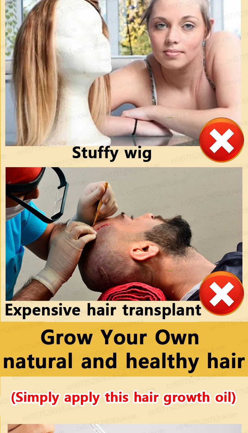 hair growth oil, Repair baldness, hairline, seborrheic alopecia hair care  fast shipping  hair oil