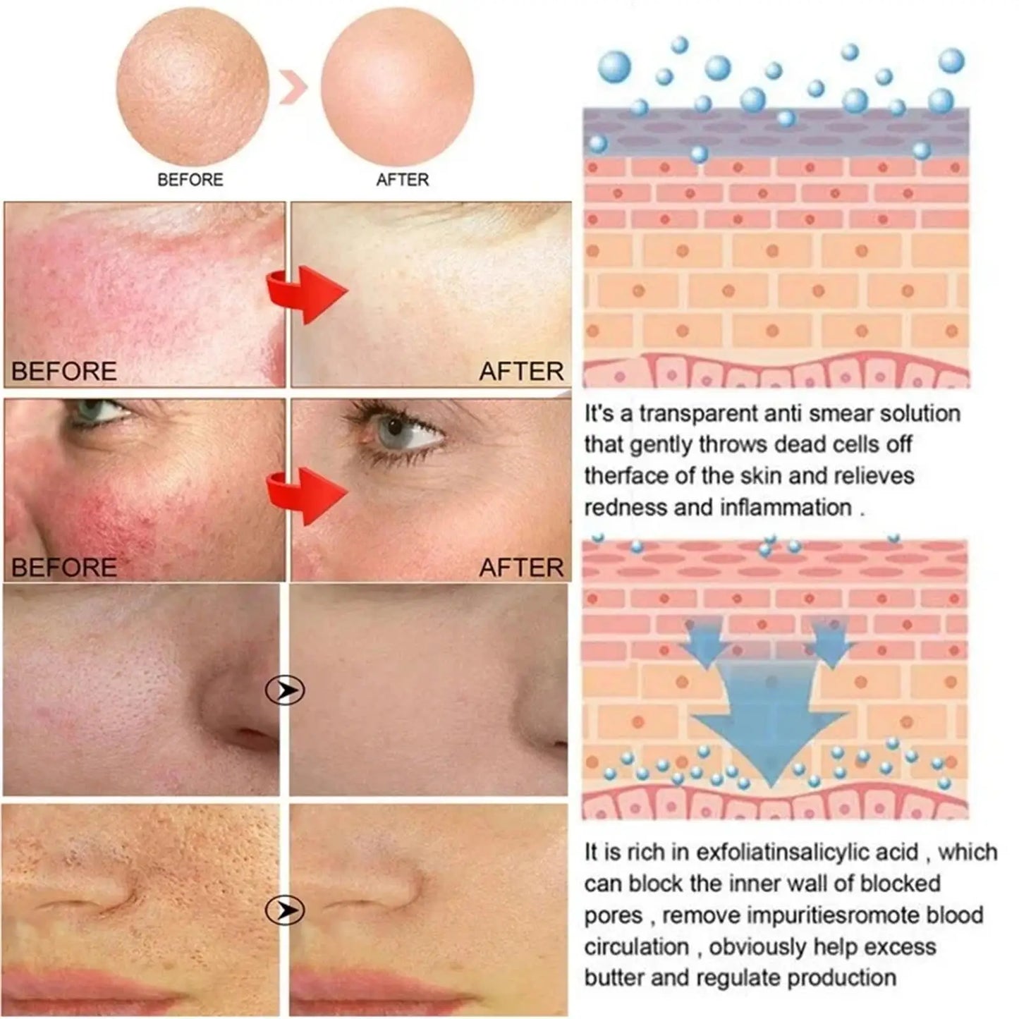 Facial Redness Repair Capsule Oil Improve Sensitive Skin Dryness Moisturizer Soothing Serum Removal Rosacea Korean Cosmetics