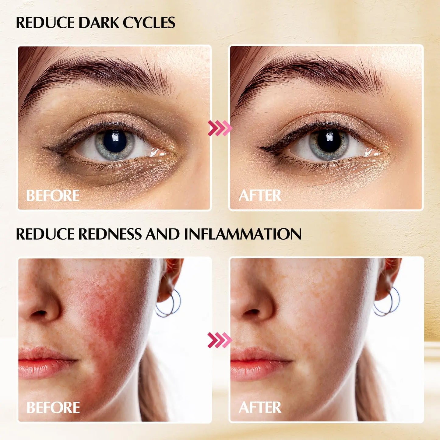 Sticks Facial Skin Care Ice Globes for Women Face Eyes, Face Beauty Tools Esthetician Supplies Cooling Spa Globes