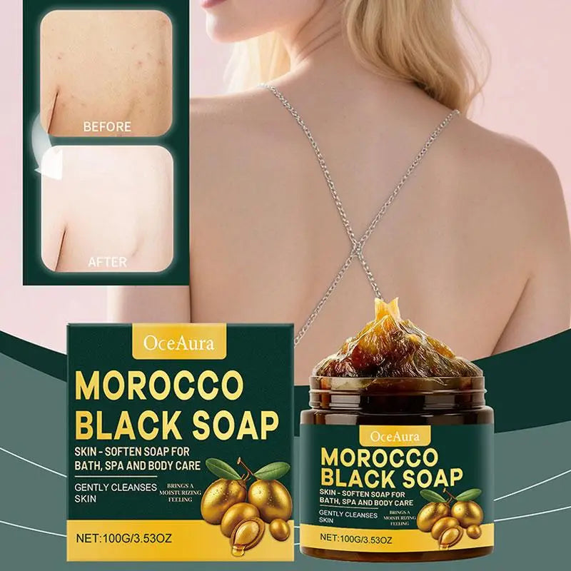 1/2/3pcs Morocco Black Soap Deep Cleaning Remove Dead Skin Cells Gentle Care Body Moisturizing Brighten Skin Smoothing Soap 100g