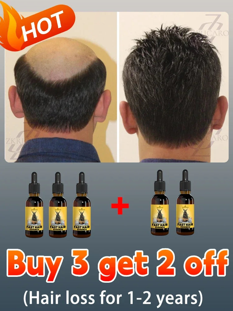 hair growth oil, Repair baldness, hairline, seborrheic alopecia hair care  fast shipping  hair oil