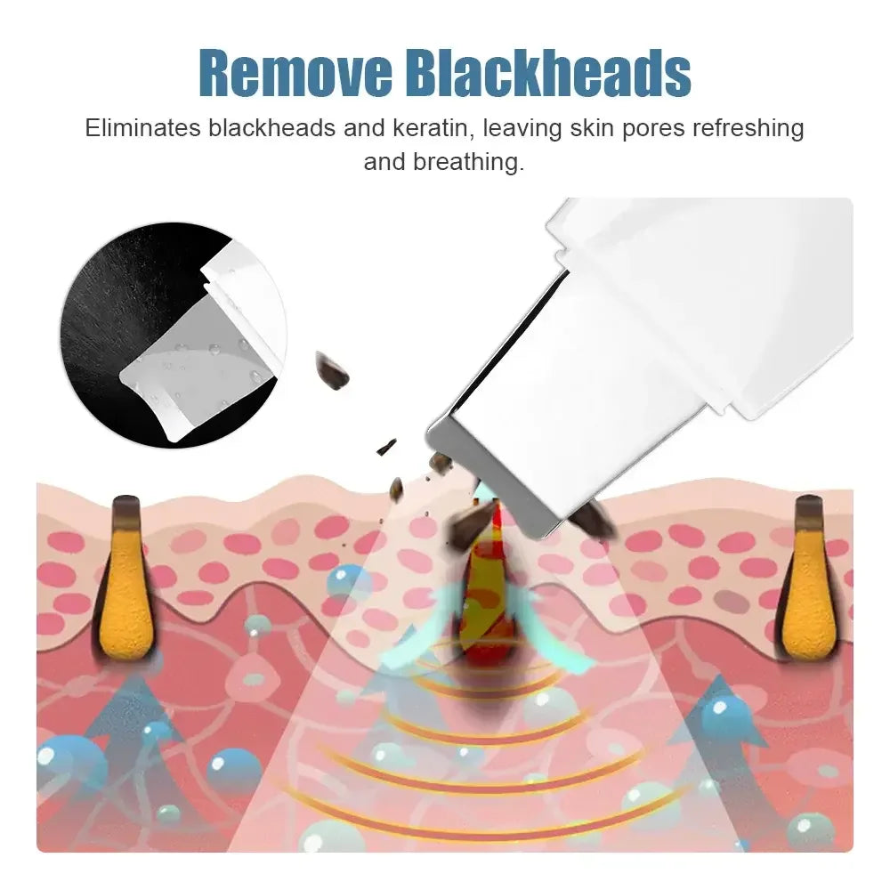 Portable Skin Scrubber Peeling Machine 90g Facial Peeling Device USB Rechargeable Blackhead Remover Travel Beauty Tool