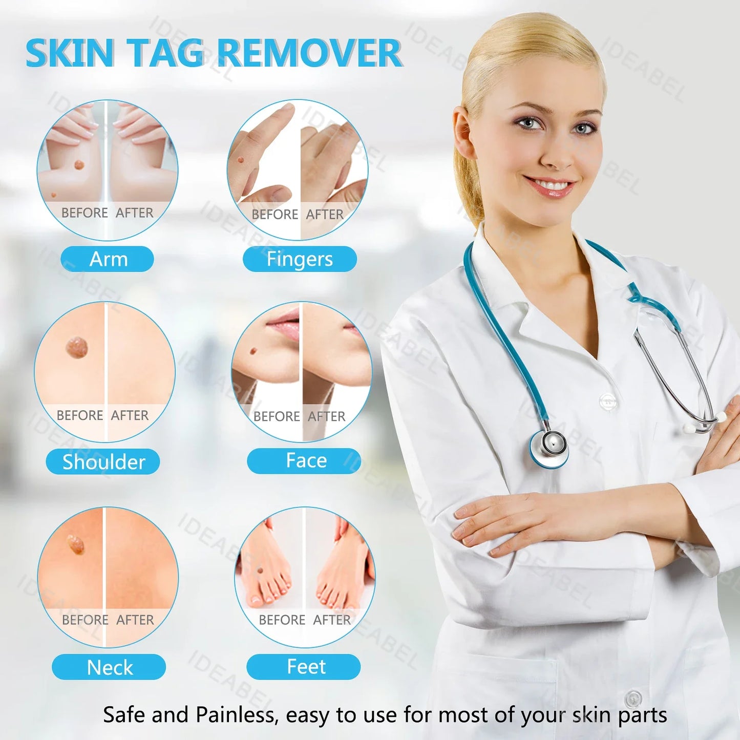 3 IN 1 Auto Micro Skin Tag Remover Device Standard And Micro Skin Tag Removal Kit Adult Mole Wart Remover Face Care Beauty Tools