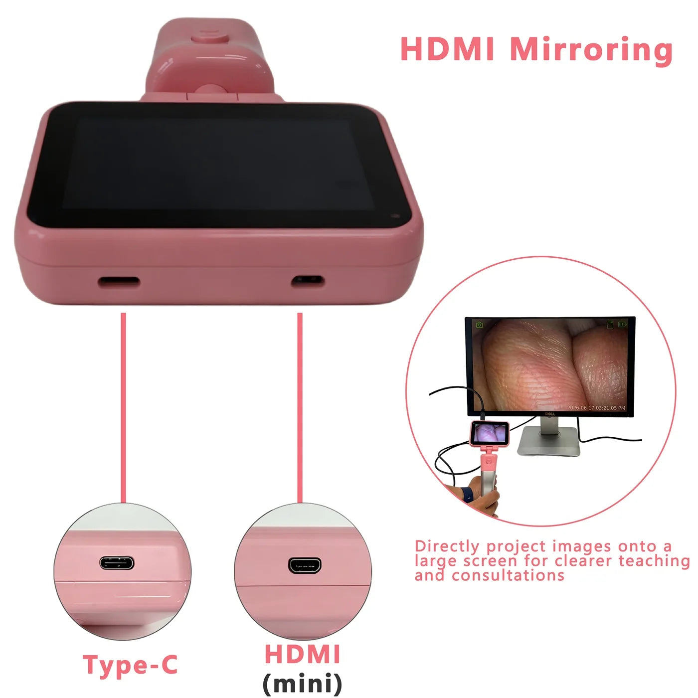 3.5" Touch Screen Video Laryngoscope for Anesthesia, 6 Blades Optional & Customizable Combination