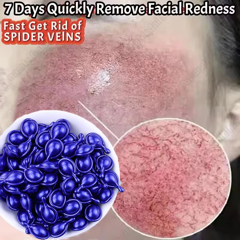 Facial Redness Repair Capsule Oil Improve Sensitive Skin Dryness Moisturizer Soothing Serum Removal Rosacea Korean Cosmetics