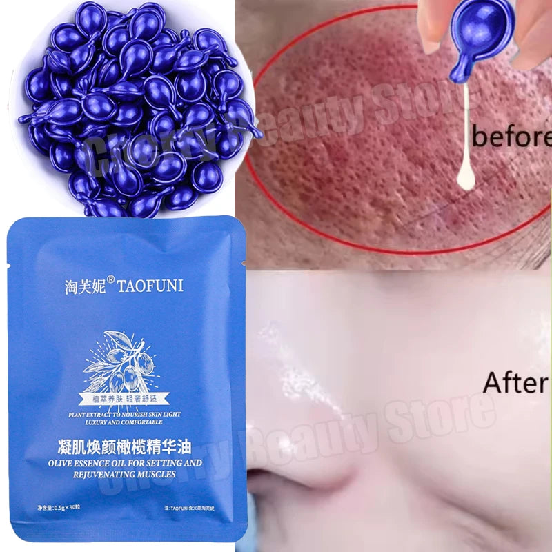 Facial Redness Repair Capsule Oil Improve Sensitive Skin Dryness Moisturizer Soothing Serum Removal Rosacea Korean Cosmetics