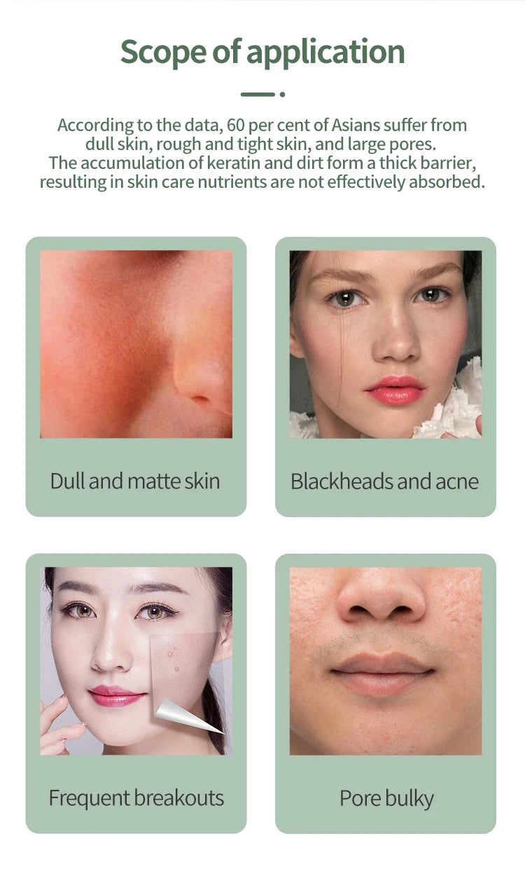 Portable Skin Scrubber Peeling Machine 90g Facial Peeling Device USB Rechargeable Blackhead Remover Travel Beauty Tool