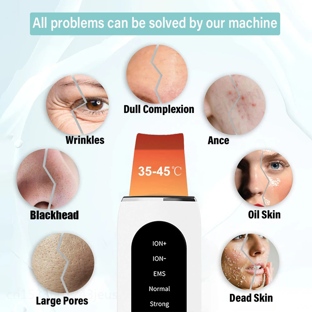 Ultrasonic Skin Scrubber Facial Peeling Machine Face Scrubber Acne Pore Deep Cleaning Facial Cleaning Spatula Blackhead Remover