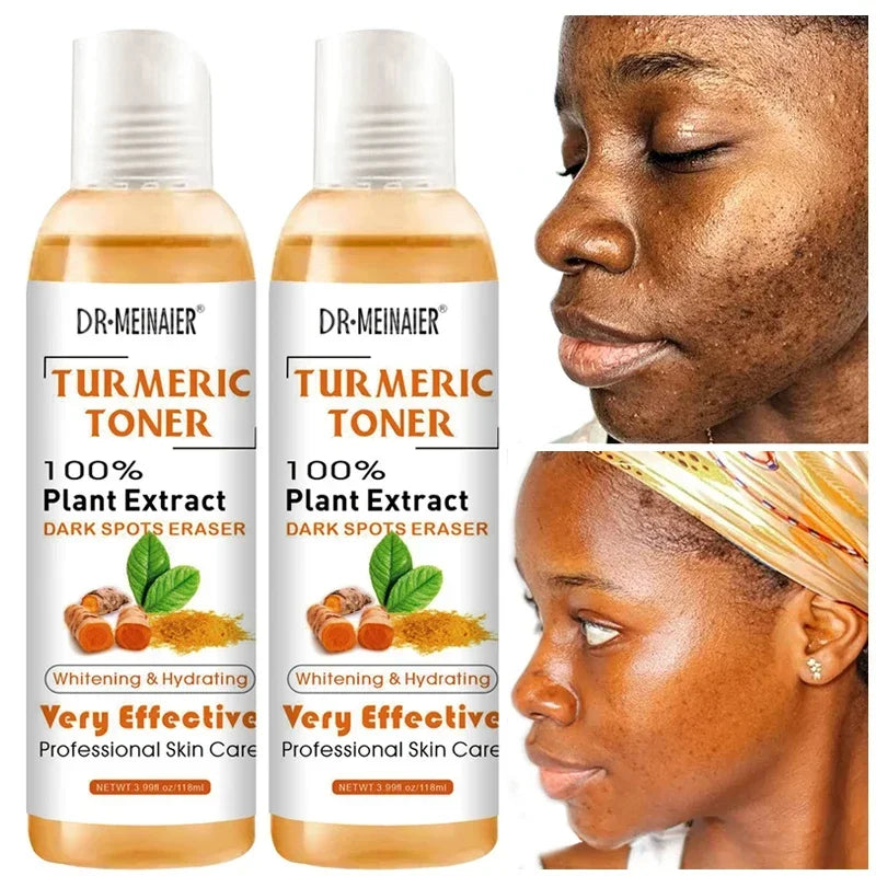 2pcs Turmeric Toner Lightening Skin Dark Corrector Moisturizing Face Serum Vitamin C Ginger Essence Korean Cosmetics Beauty