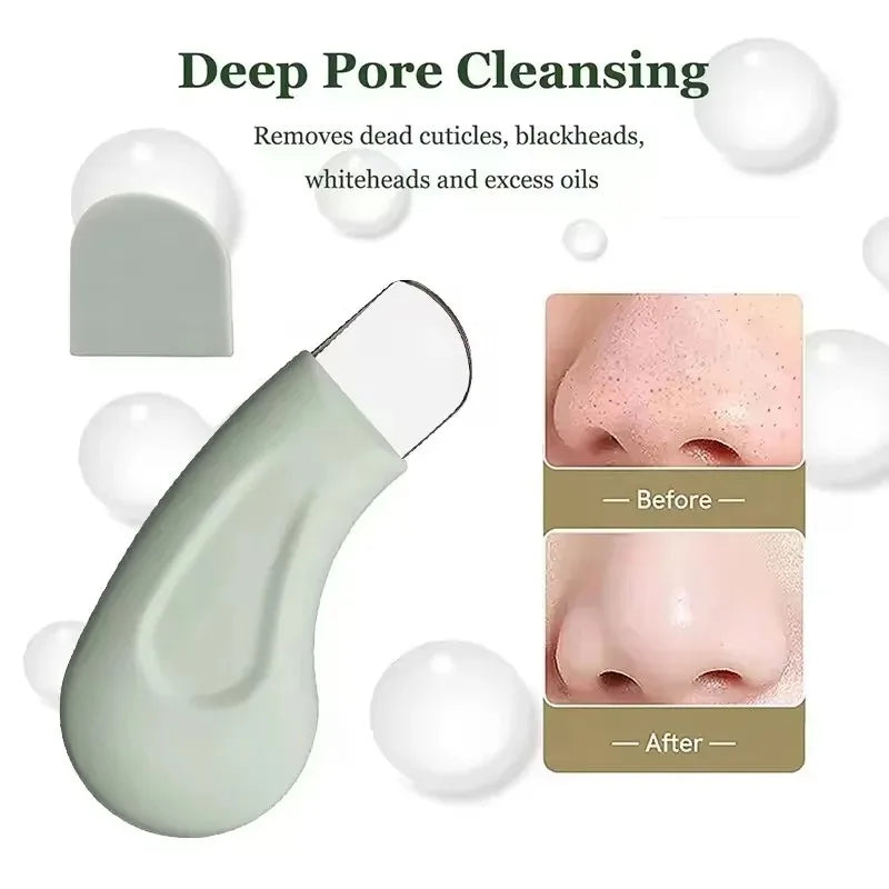 Blackhead Whitehead Removal Tool - Deep Cleansing Pore Cleaner, Skin Care Beauty Tools for Face Nose Women