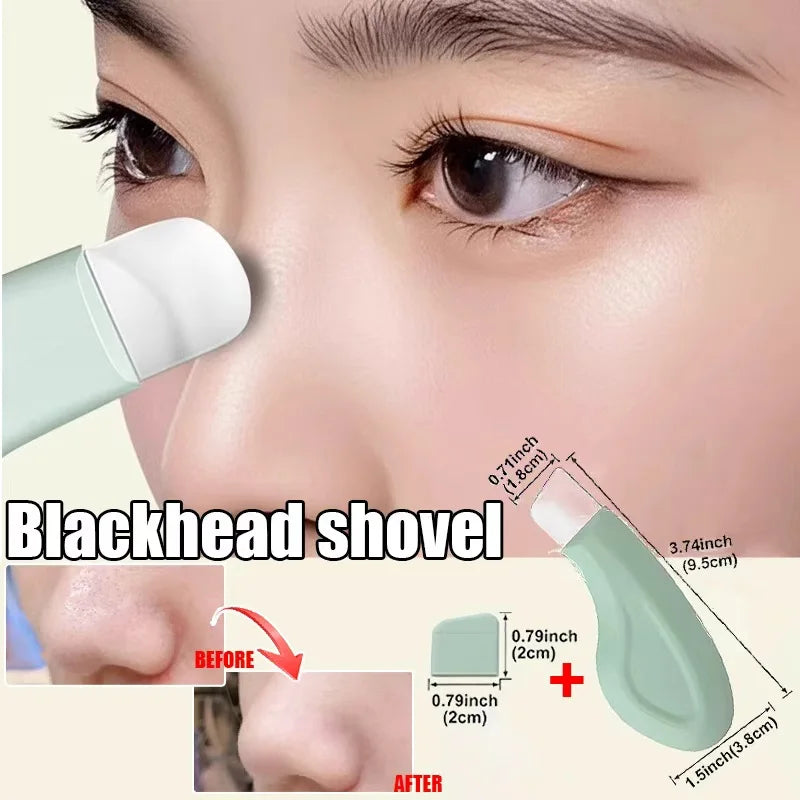 Blackhead Whitehead Removal Tool - Deep Cleansing Pore Cleaner, Skin Care Beauty Tools for Face Nose Women