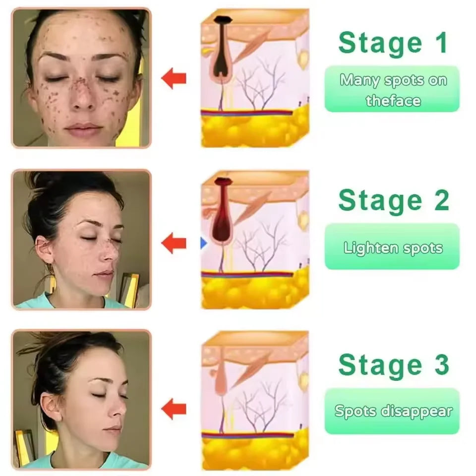Orange Exfoliating Peeling Gel Facial Scrub Moisturizing Nourish Repair Scrubs Blackhead Removal Face Cleanser Korean Cosmetics