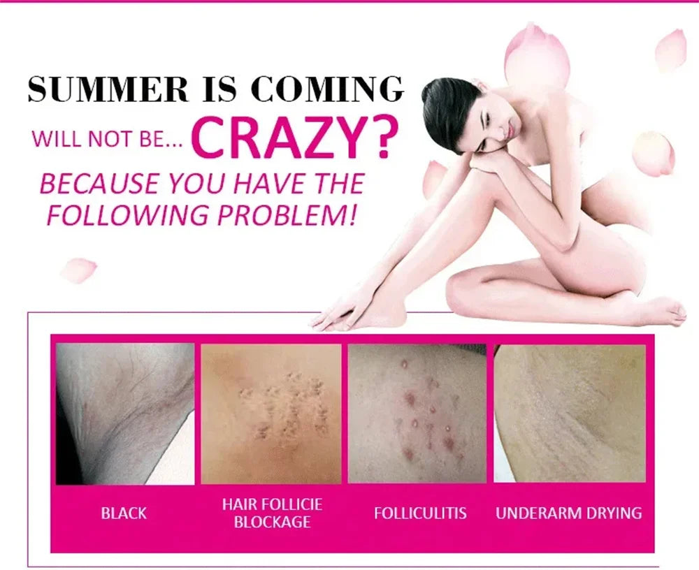 Body Whitening Soap Underarm Knee Bleaching Soap Chicken Skin Removal Dark Spot Removal Dead Skin Moisturize Brighten Body Care