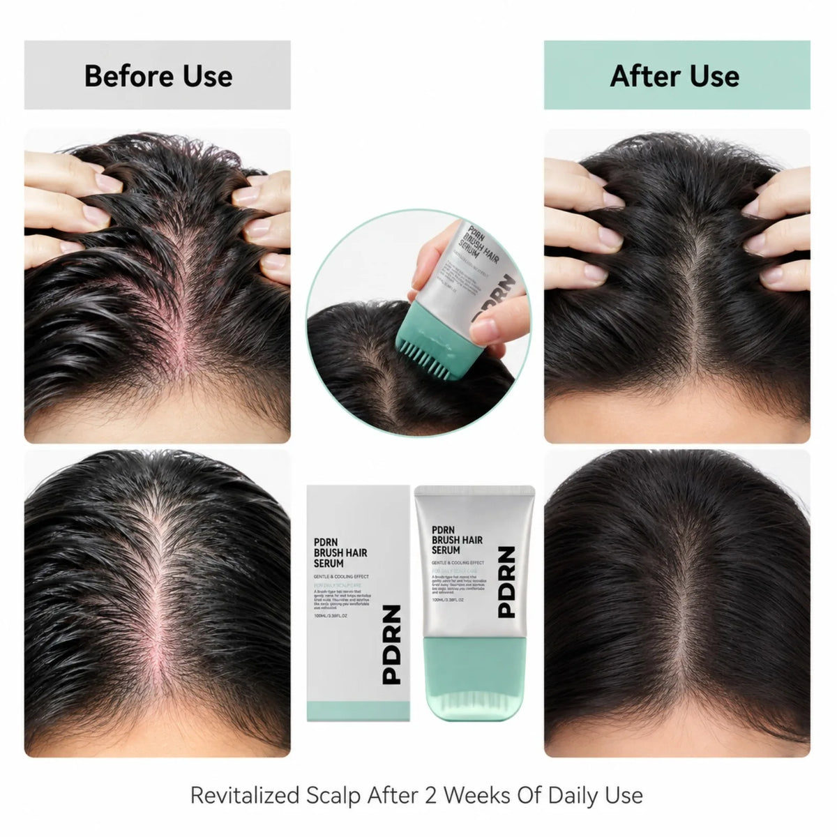 PDRN Hair Serum Centella Scalp Soothing Serum Nourishing Calm Tense Scalp Cooling Daily Scalp Care Sensitive Scalp Massager