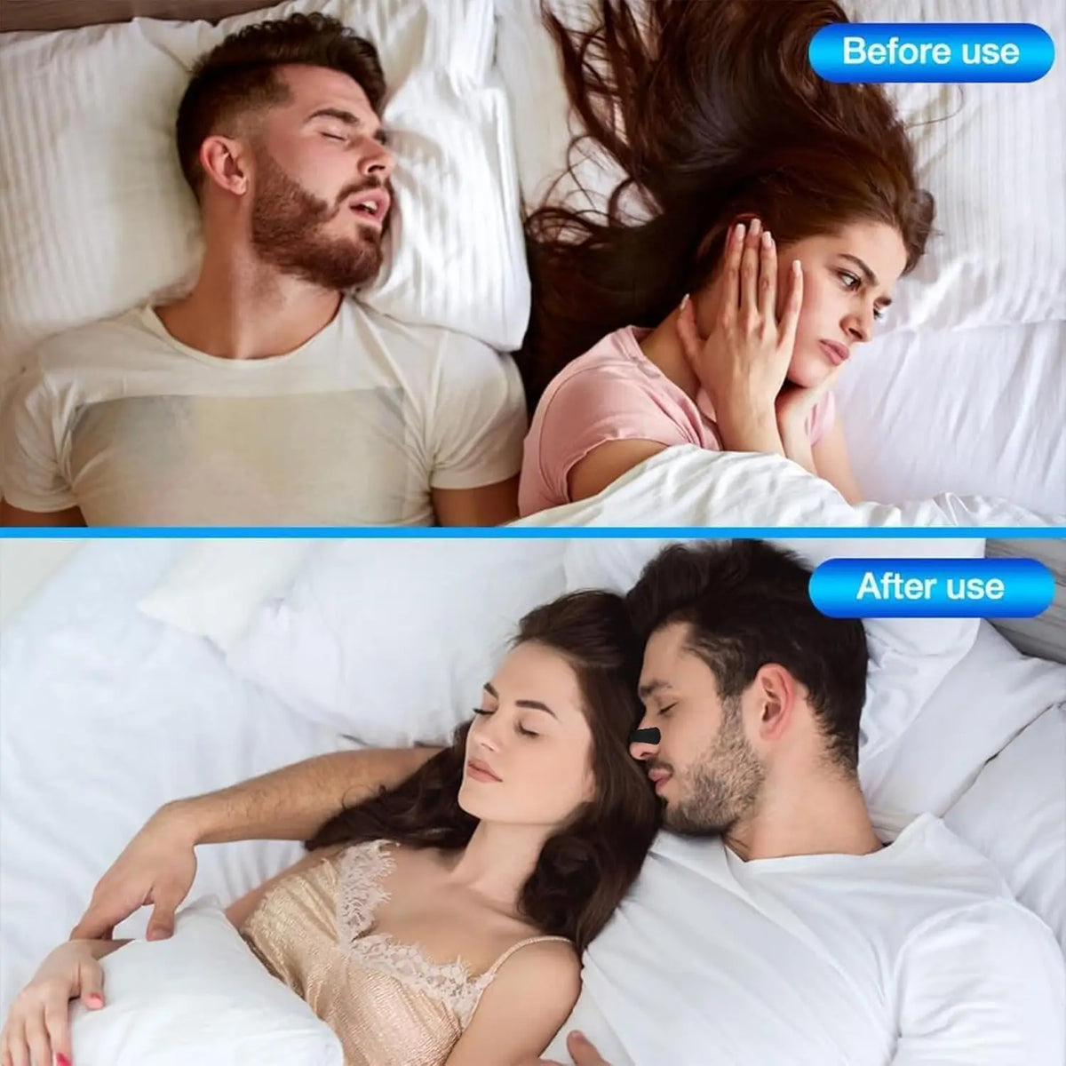 Anti Snoring Nose Strips for Breathing Correction Physical Expansion Breathable 2026 Patch Better Sleep Anti-Snoring Nasal Stri