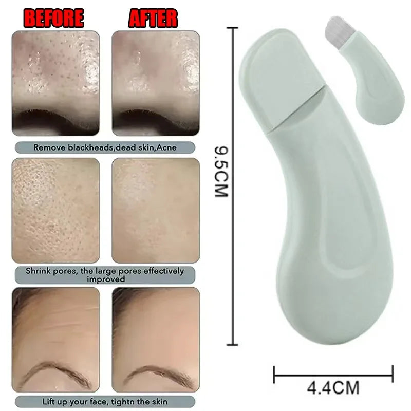 Blackhead Whitehead Removal Tool - Deep Cleansing Pore Cleaner, Skin Care Beauty Tools for Face Nose Women
