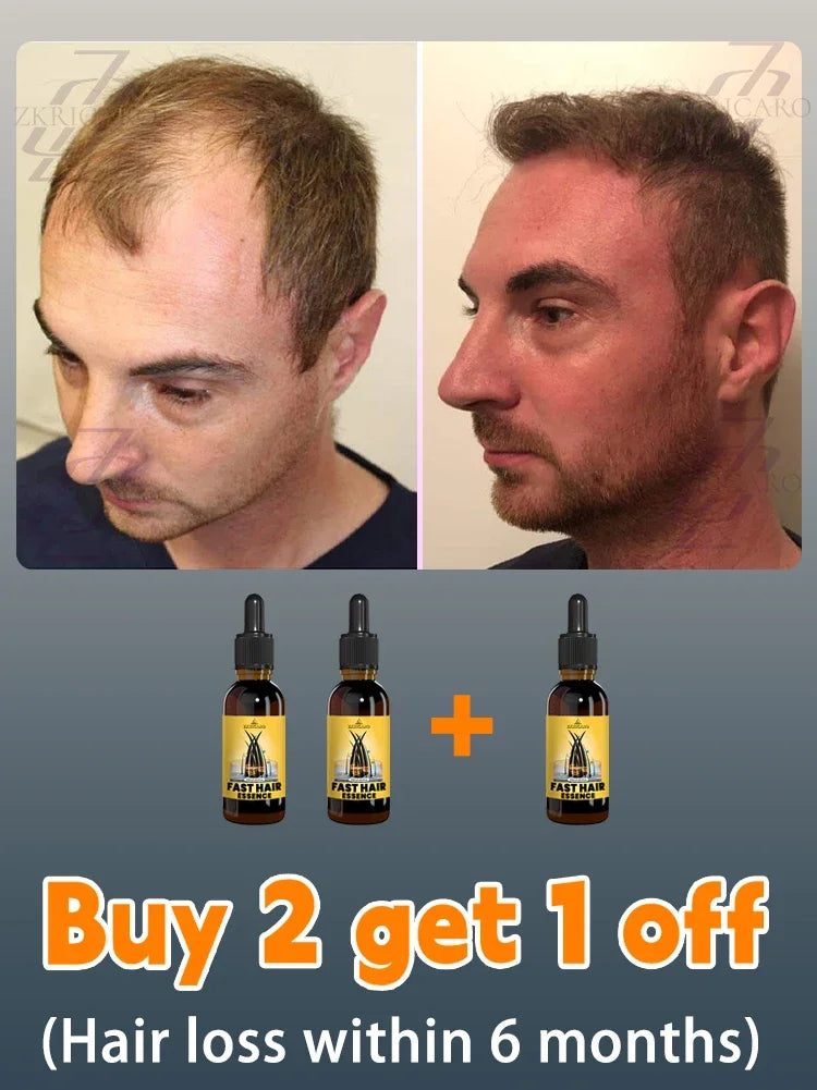 hair growth oil, Repair baldness, hairline, seborrheic alopecia hair care  fast shipping  hair oil