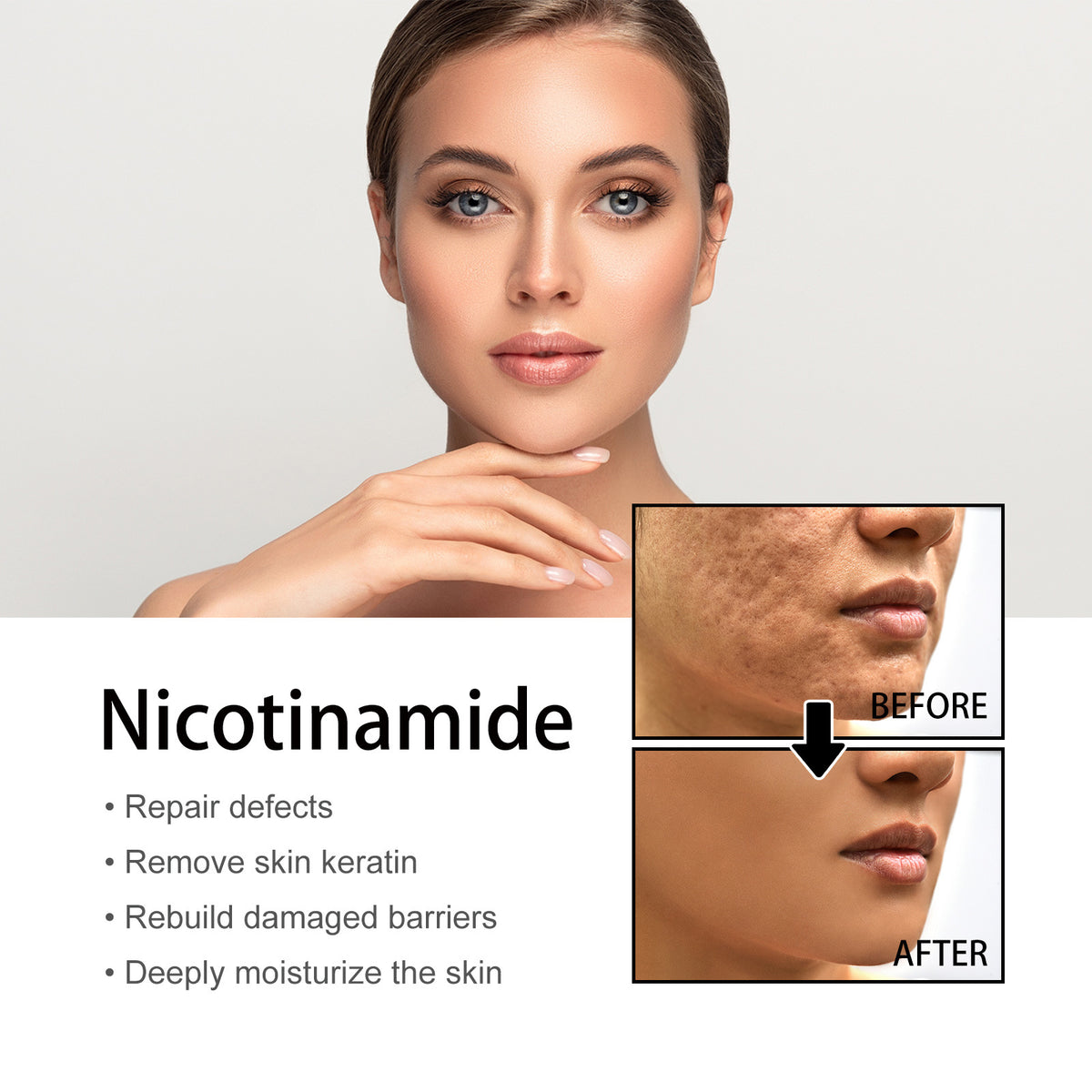 Nicotinamide Whitening Serum Lighten Acne Marks Shrinking Pores Improve Roughness Skin Brightening Moisturizing Facial Essence