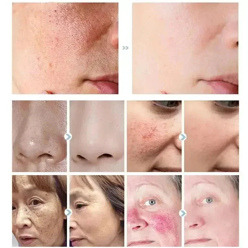 Facial Redness Repair Cream Improve Sensitive Skin Dryness Moisturizer Hydrating Sooth Lotion Removal Rosacea Korean Cosmetics