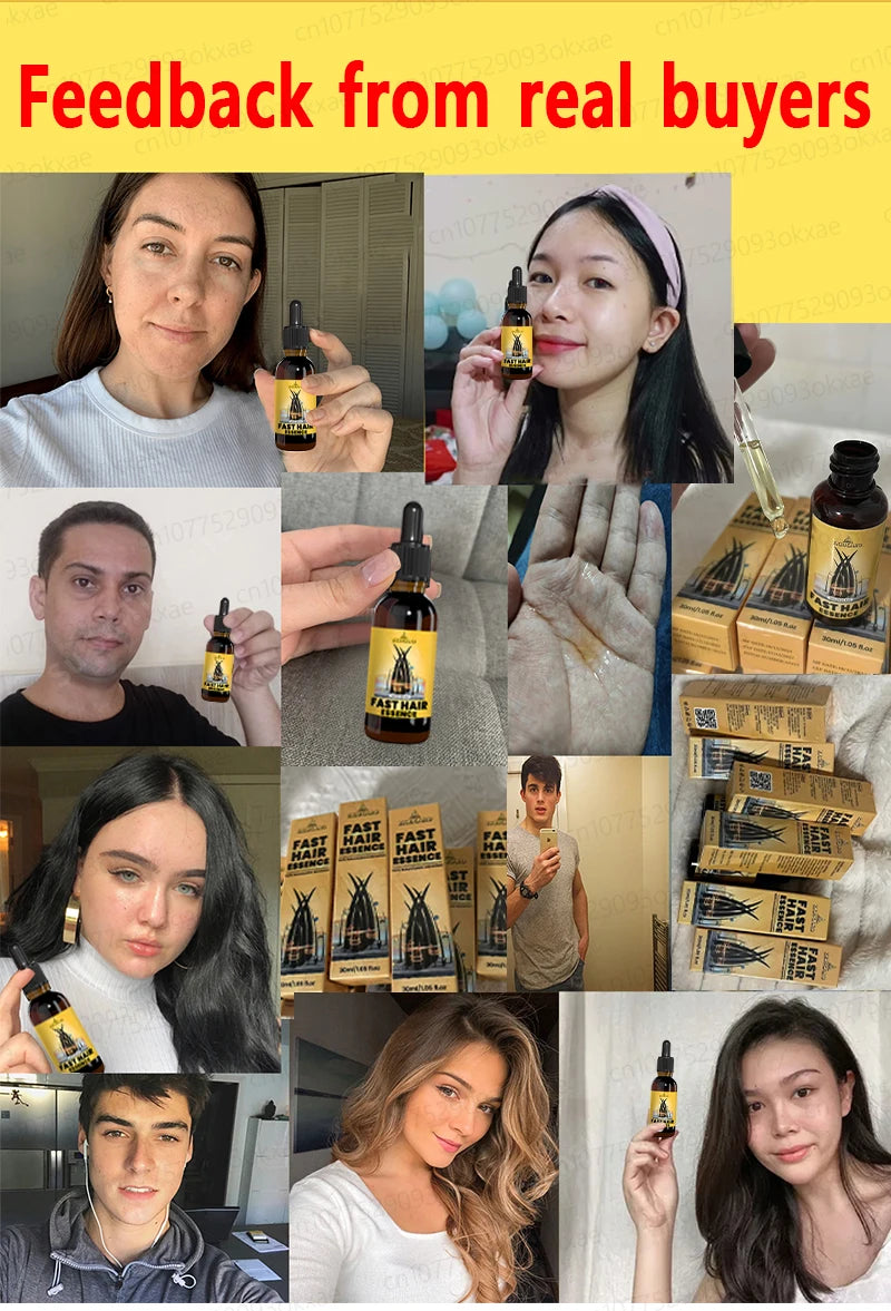 hair growth oil, Repair baldness, hairline, seborrheic alopecia hair care  fast shipping  hair oil