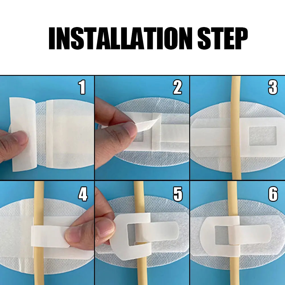 5-100Pcs Drainage Tube Sterile Applicator Catheter Fixation Patch for Drainage/Biliary/Renal Biopsy Catheters Adhesive Patch