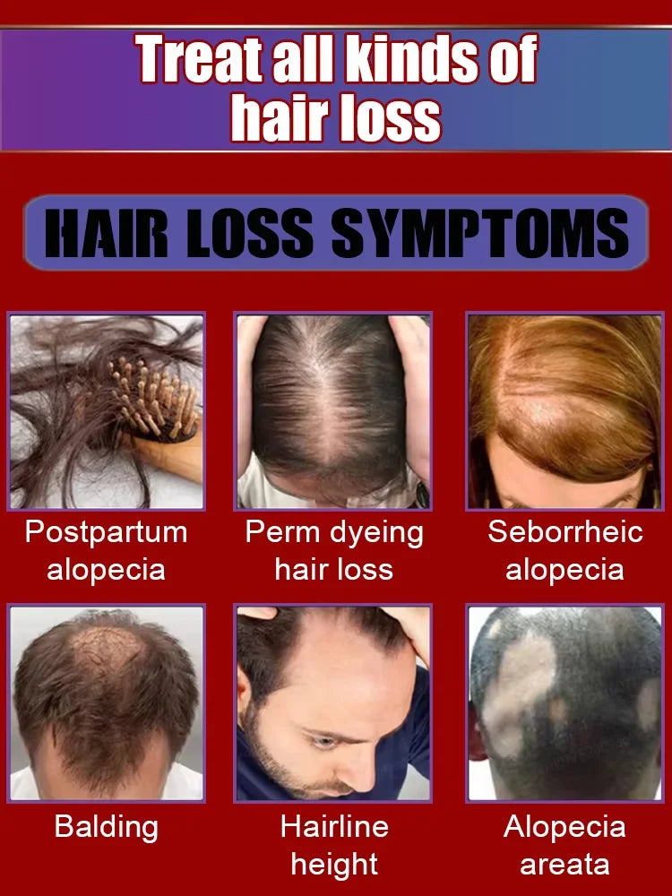 hair growth oil, Repair baldness, hairline, seborrheic alopecia hair care  fast shipping  hair oil
