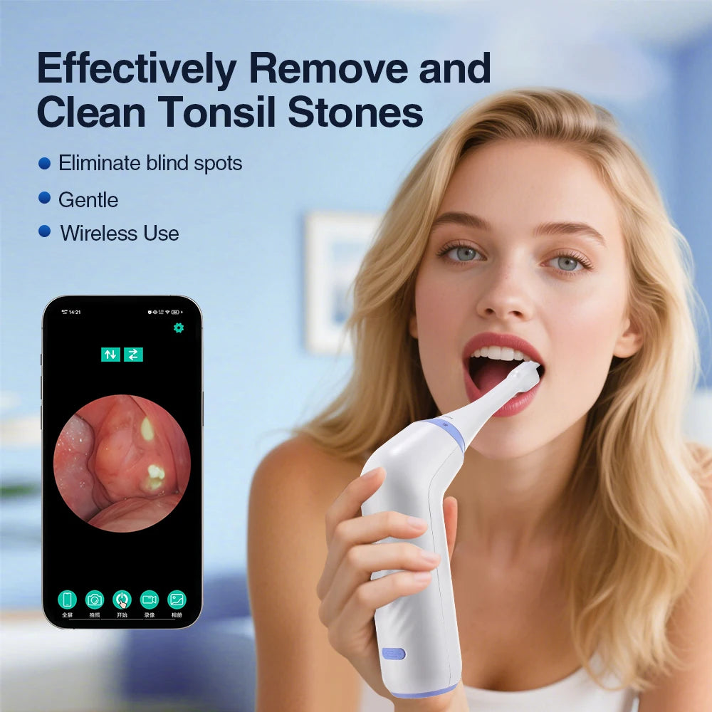 Electric Visual Tonsil Stone Remover Kit with LED Light HD Camera 3 Suction Modes Tonsil Stone Removal Fresher Mouth Oral Care