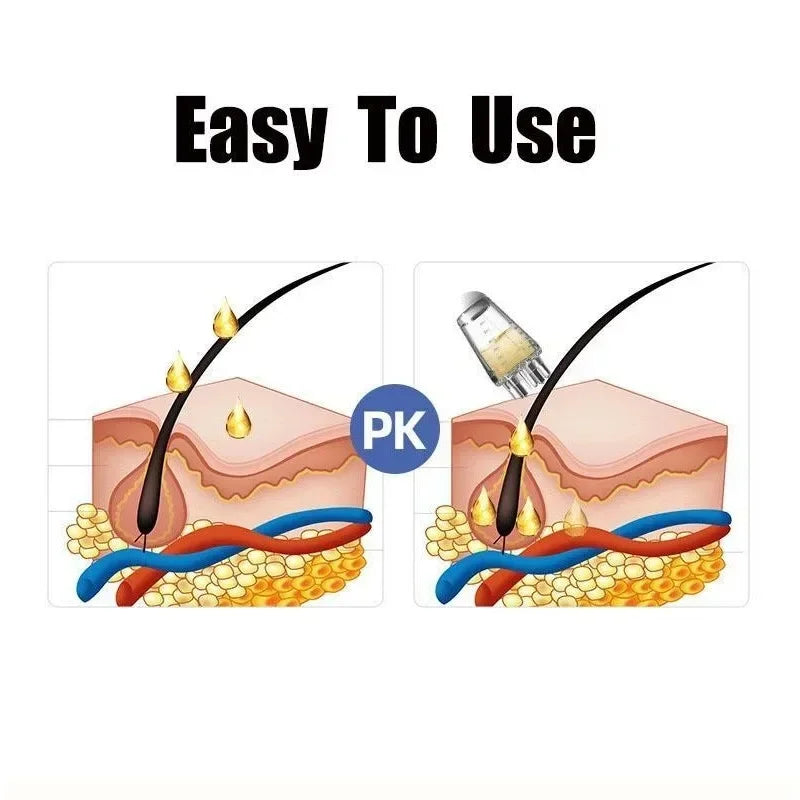 1 Pcs Five Needle Scalp Applicator Portable Mini Head Essential Oil Ball Massage Comb Hair Growth Liquid Application Guide Tool