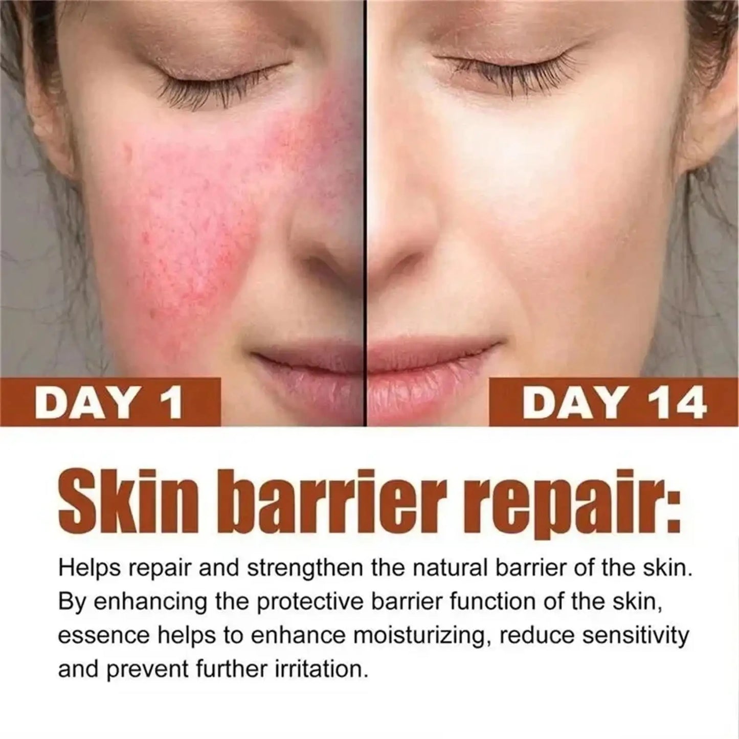 Facial Redness Repair Capsule Oil Improve Sensitive Skin Dryness Moisturizer Soothing Serum Removal Rosacea Korean Cosmetics