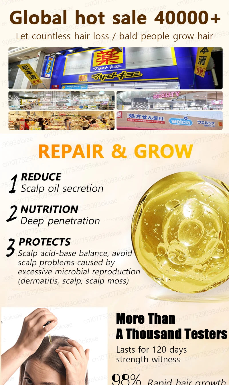 hair growth oil, Repair baldness, hairline, seborrheic alopecia hair care  fast shipping  hair oil