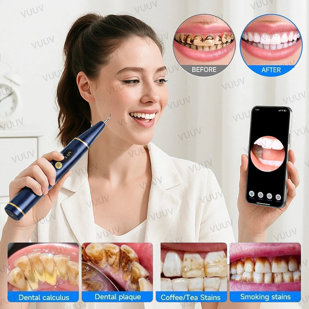 Visible Ultrasonic Dental Scaler Tartar Remover 5 modes with LED Light Household Teeth Cleaning Tools Dental Cleaner Oral Care