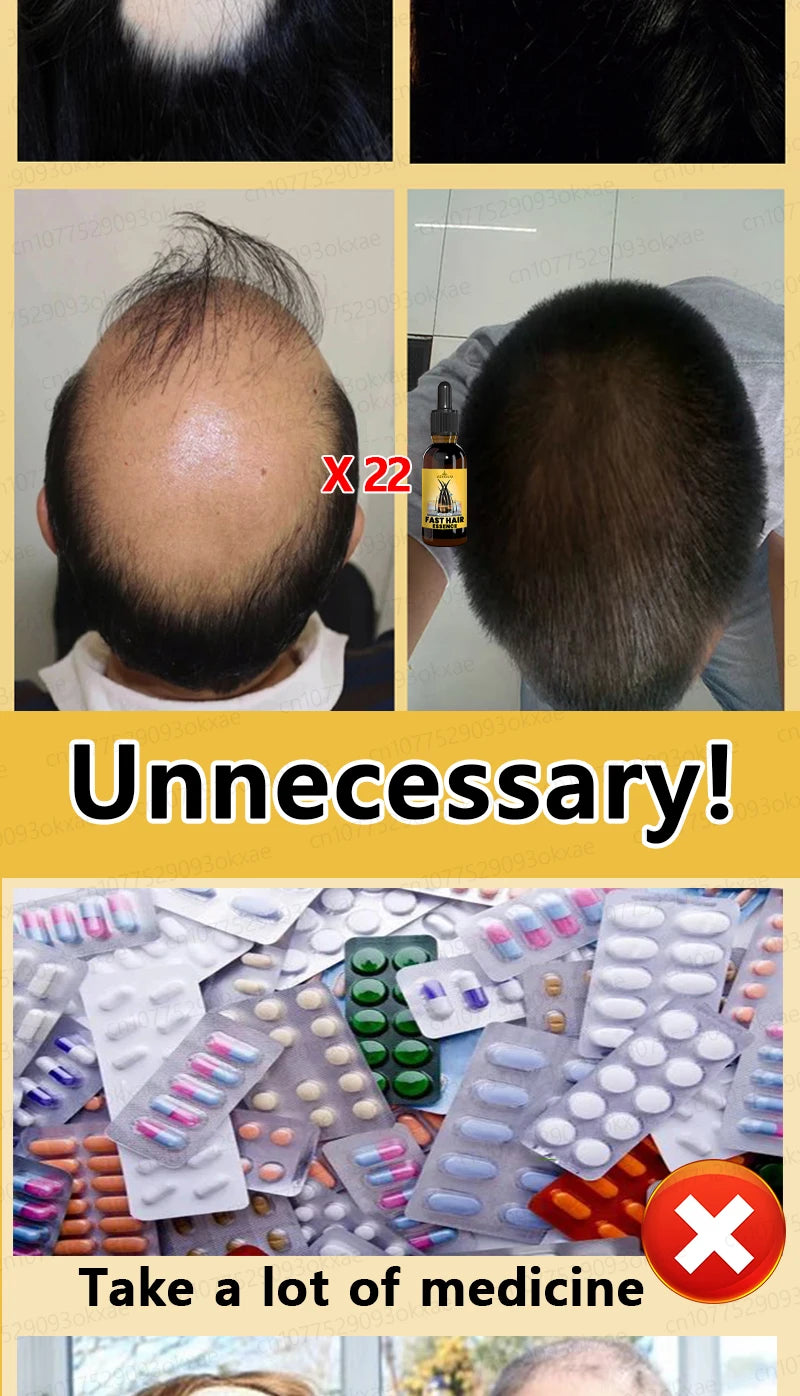 hair growth oil, Repair baldness, hairline, seborrheic alopecia hair care  fast shipping  hair oil