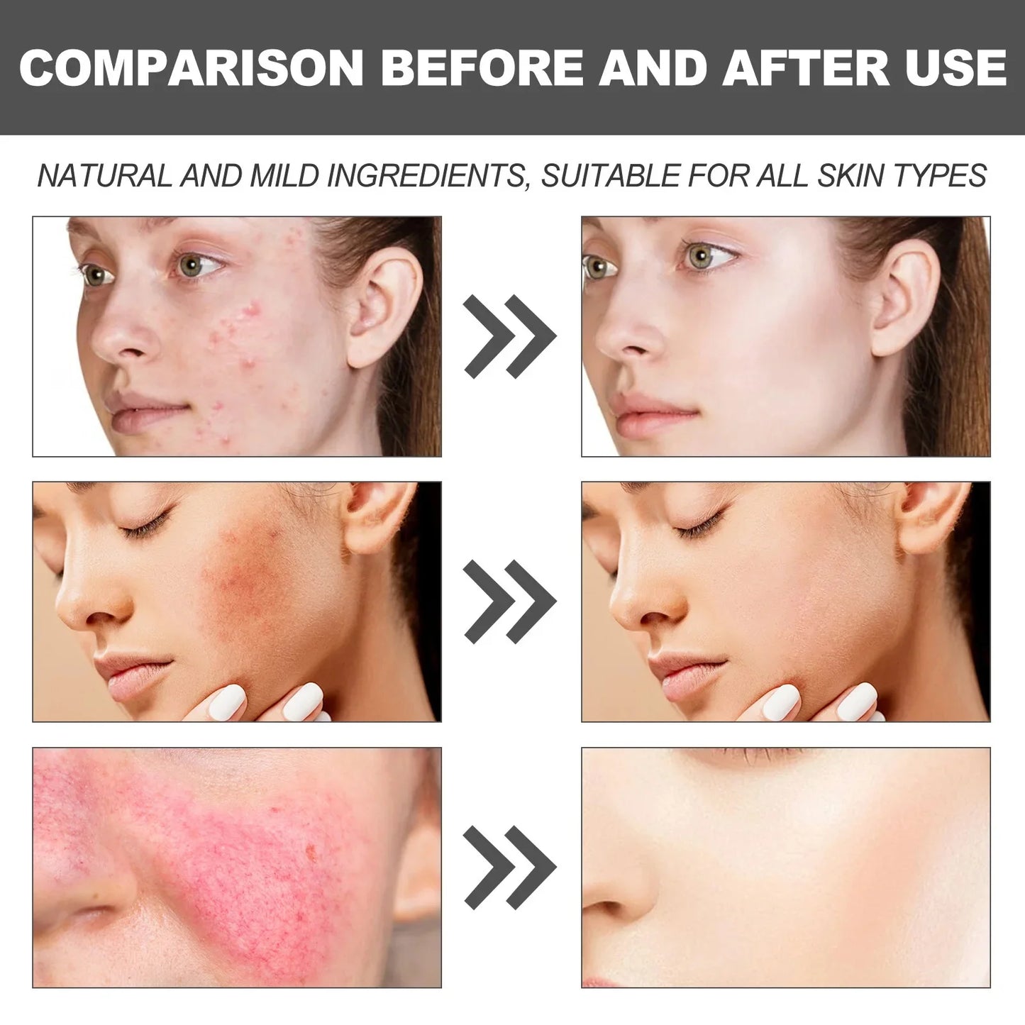 Facial Redness Repair Capsule Oil Improve Sensitive Skin Dryness Moisturizer Soothing Serum Removal Rosacea Korean Cosmetics
