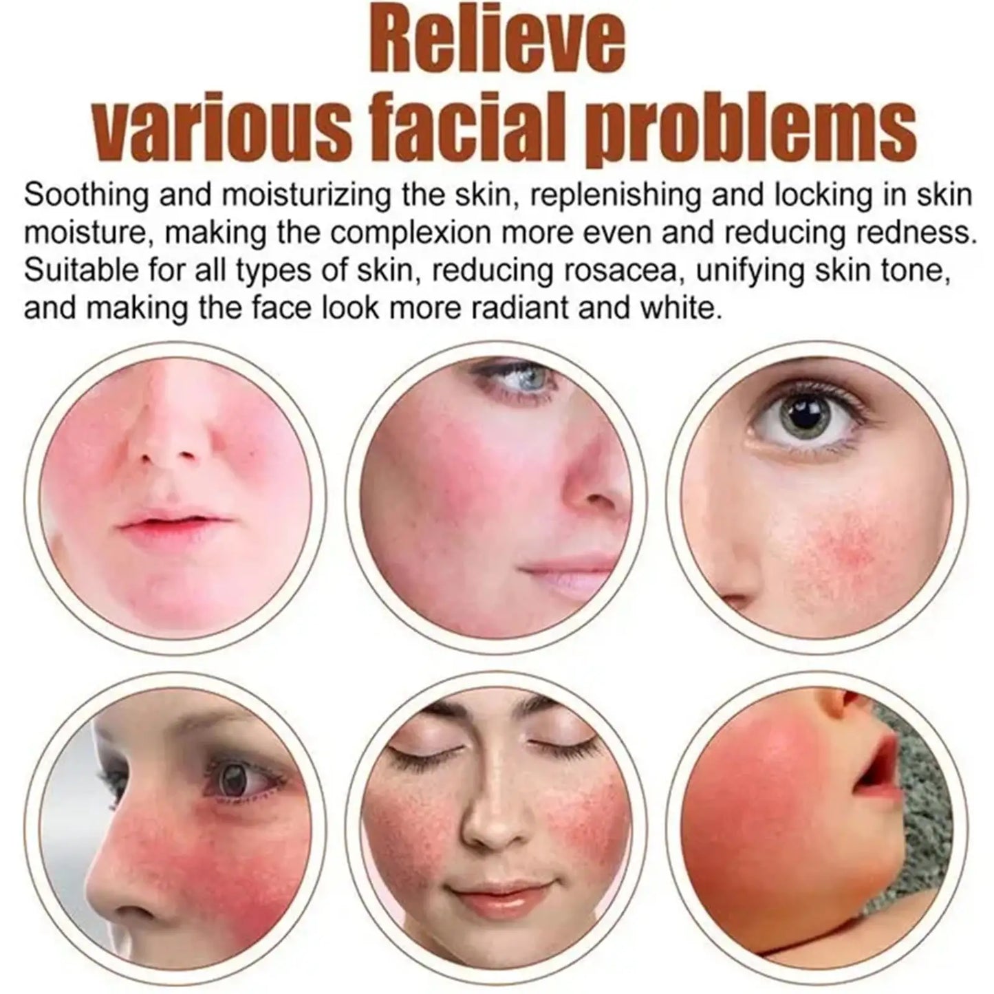 Facial Redness Repair Capsule Oil Improve Sensitive Skin Dryness Moisturizer Soothing Serum Removal Rosacea Korean Cosmetics