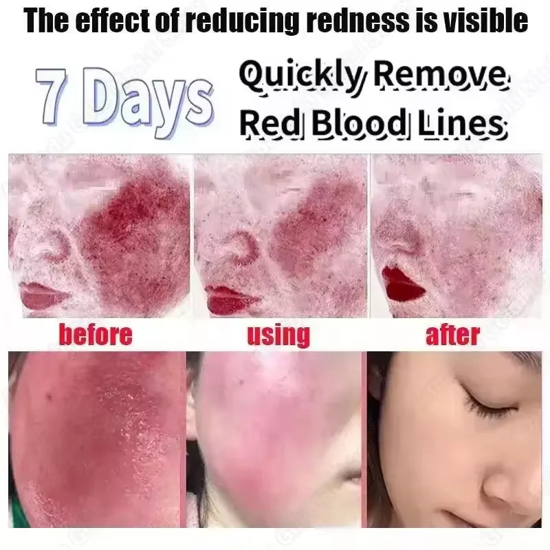 Facial Redness Repair Capsule Oil Improve Sensitive Skin Dryness Moisturizer Soothing Serum Removal Rosacea Korean Cosmetics
