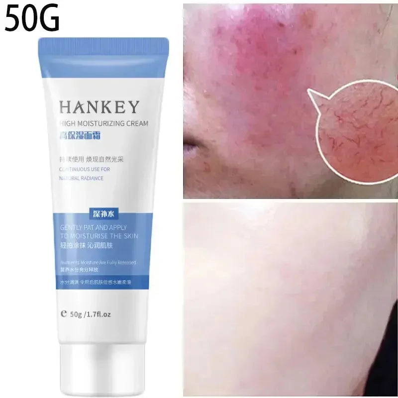 Facial Redness Repair Cream Improve Sensitive Skin Dryness Moisturizer Hydrating Sooth Lotion Removal Rosacea Korean Cosmetics
