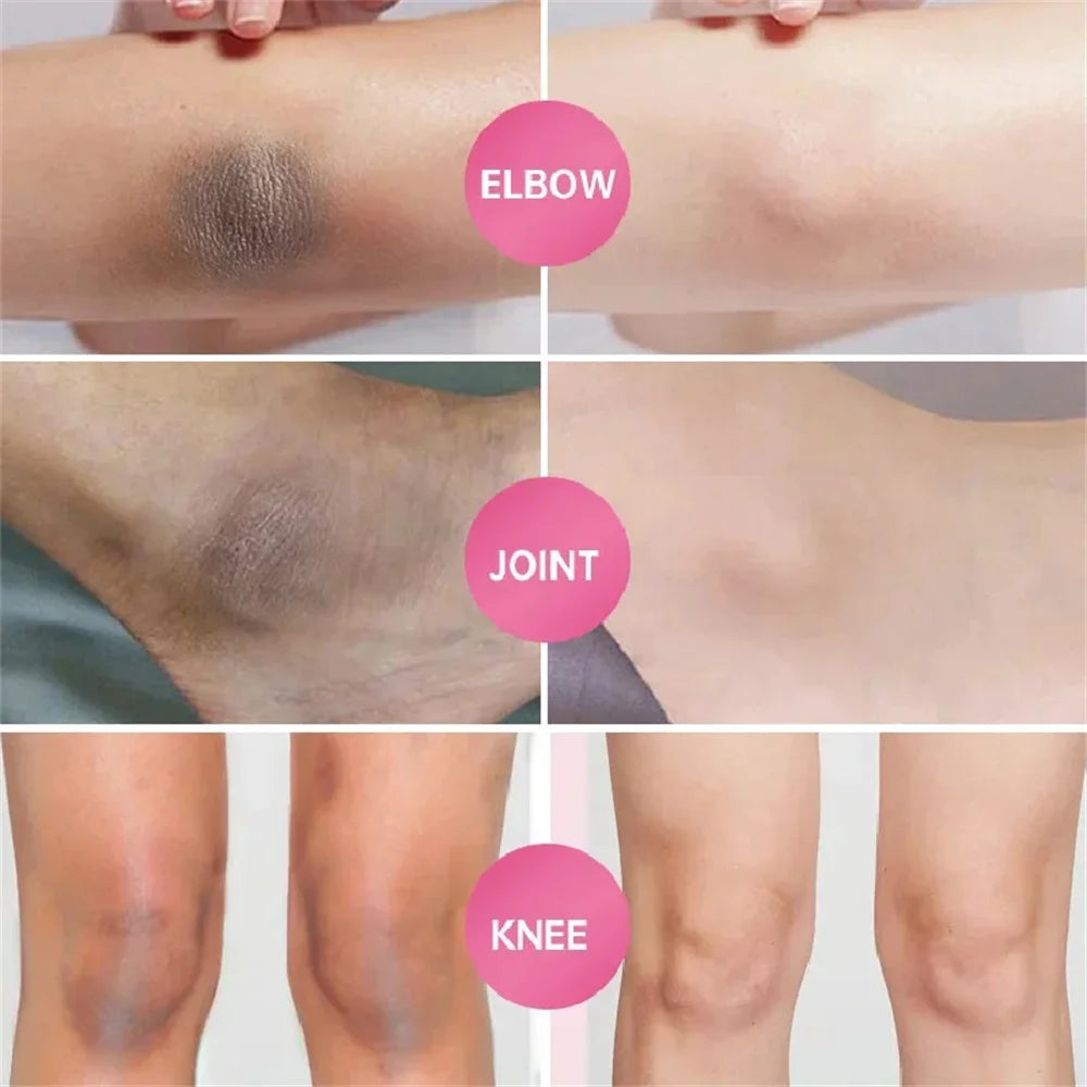 Body Whitening Soap Underarm Knee Bleaching Soap Chicken Skin Removal Dark Spot Removal Dead Skin Moisturize Brighten Body Care