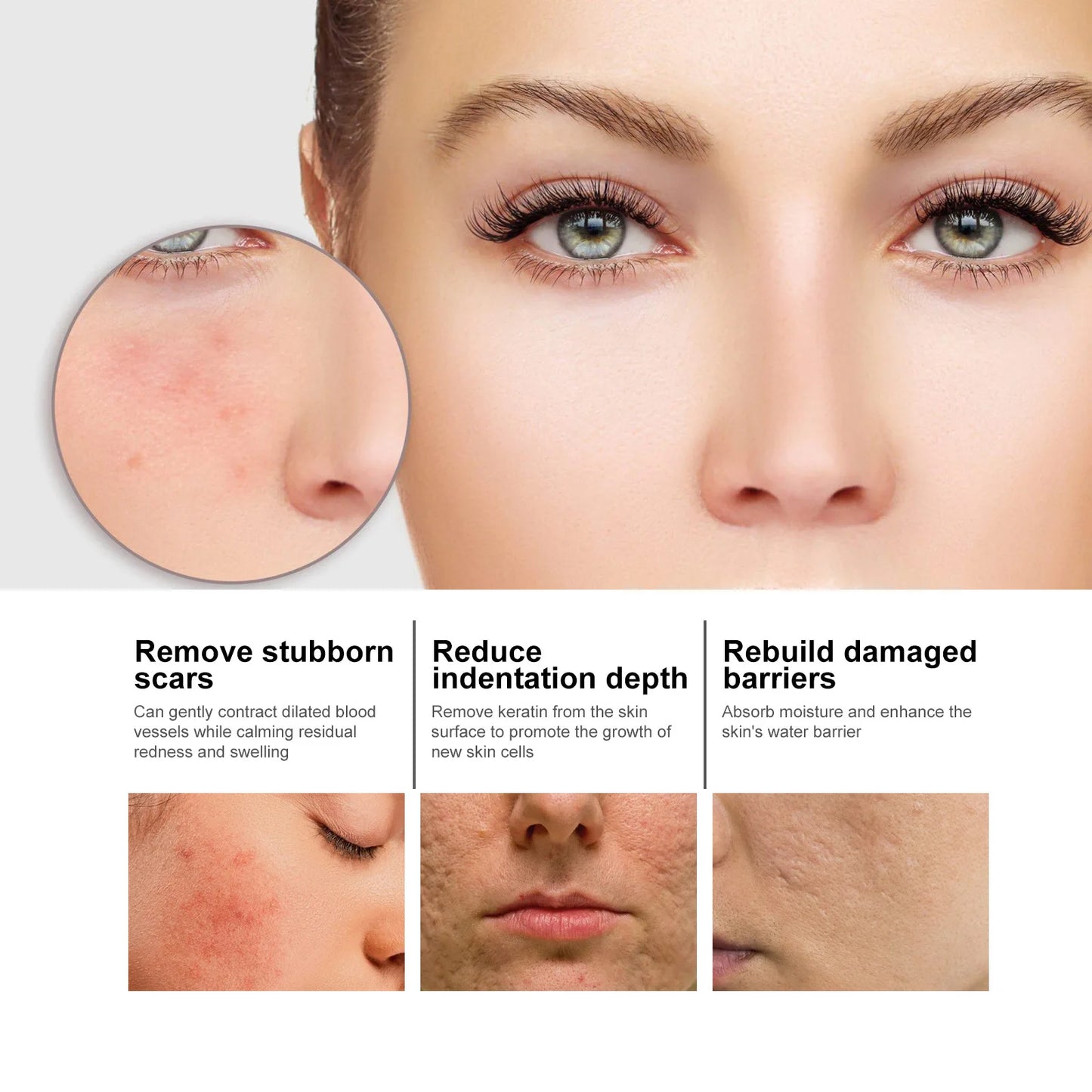 Nicotinamide Whitening Serum Lighten Acne Marks Shrinking Pores Improve Roughness Skin Brightening Moisturizing Facial Essence
