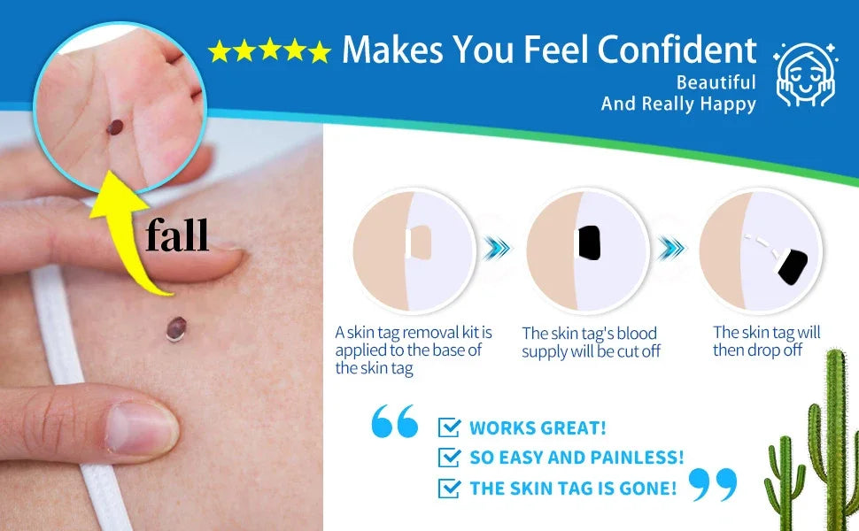 2 IN 1 Auto Micro Skin Tag Remover Device Standard And Micro Skin Tag Removal Kit Adult Mole Wart Remover Face Care Beauty Tools