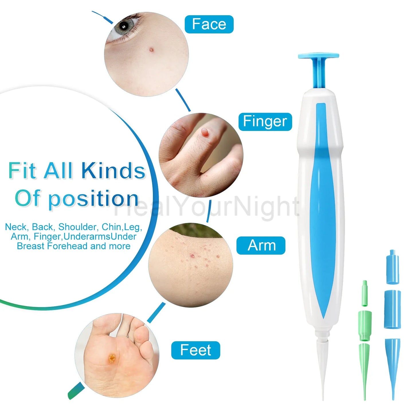 3 IN 1 Auto Micro Skin Tag Remover Device Standard And Micro Skin Tag Removal Kit Adult Mole Wart Remover Face Care Beauty Tools