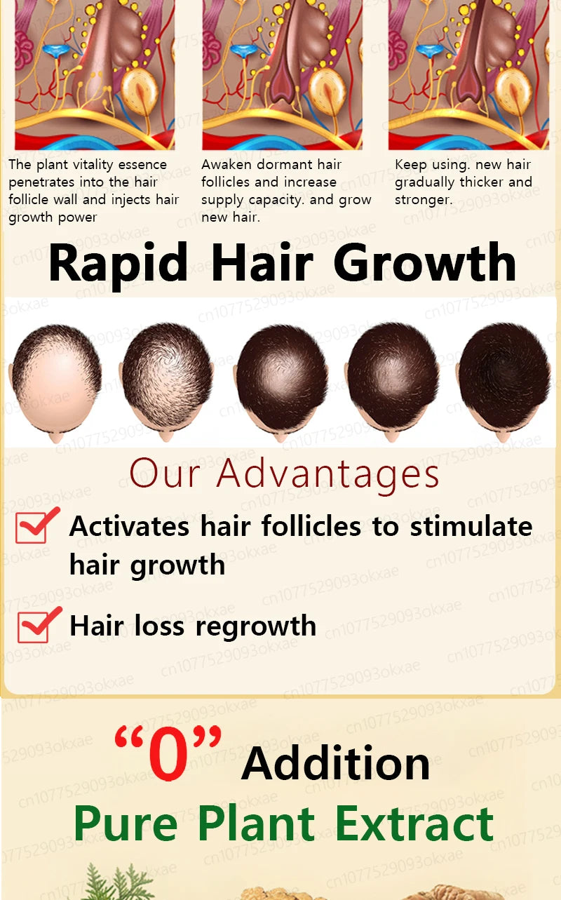hair growth oil, Repair baldness, hairline, seborrheic alopecia hair care  fast shipping  hair oil