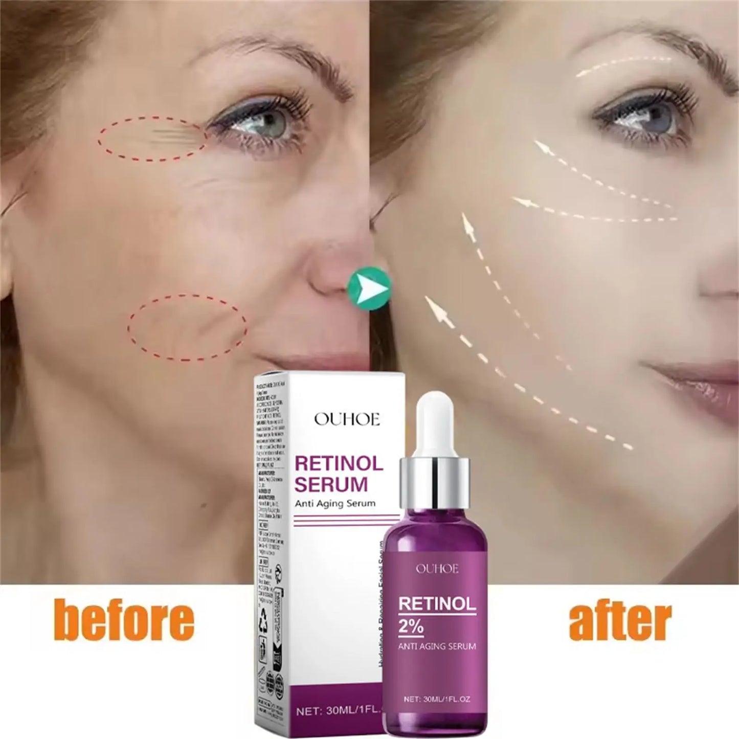 Retinol Remove Wrinkle Face Serum Lift Firming Anti Aging Fade Fine Lines Whitening Brightening Moisturizer Skin Care Cosmetics
