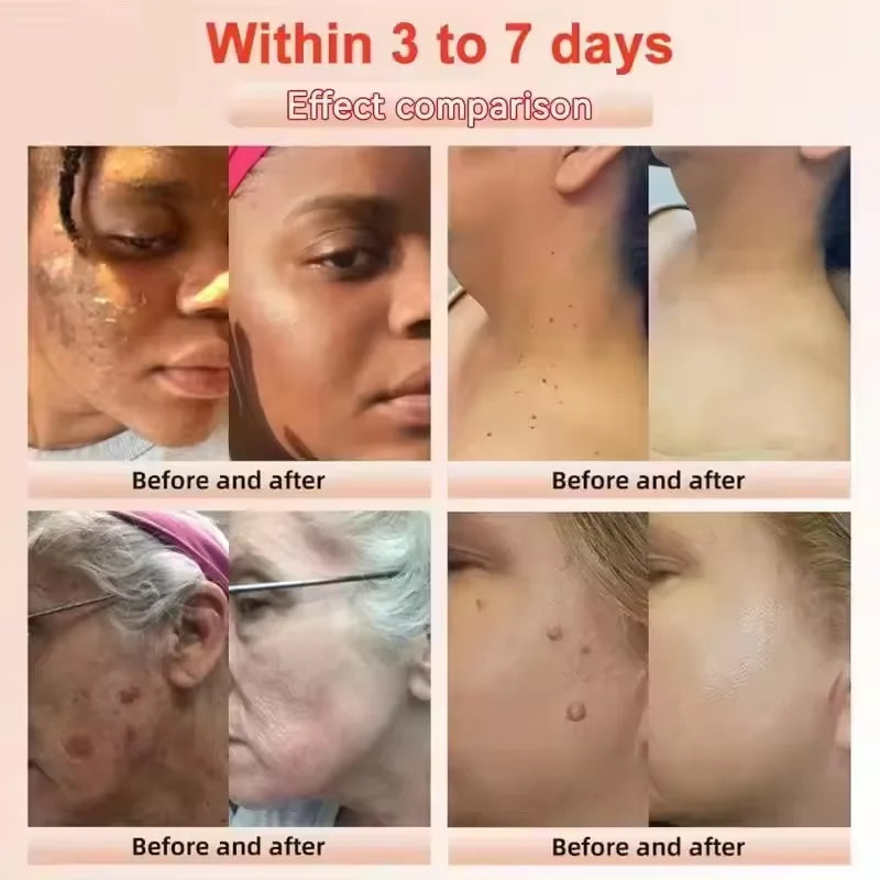 Orange Exfoliating Peeling Gel Facial Scrub Moisturizing Nourish Repair Scrubs Blackhead Removal Face Cleanser Korean Cosmetics
