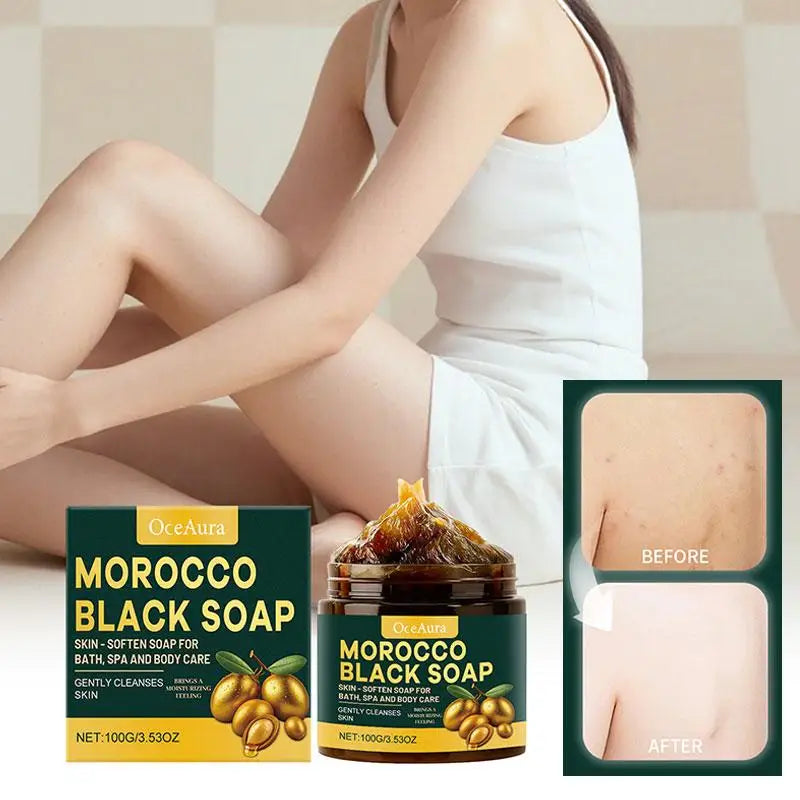 1/2/3pcs Morocco Black Soap Deep Cleaning Remove Dead Skin Cells Gentle Care Body Moisturizing Brighten Skin Smoothing Soap 100g
