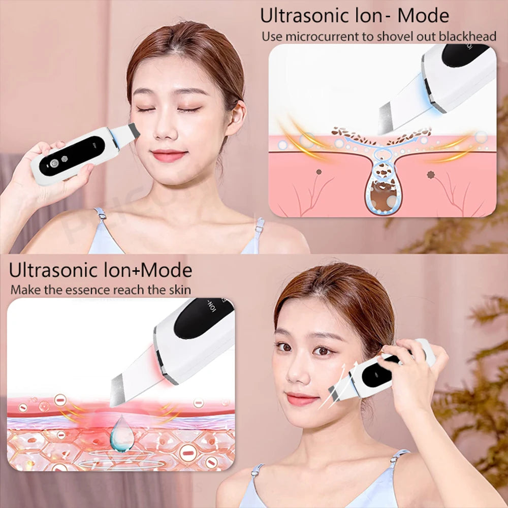 Ultrasonic Skin Scrubber Facial Peeling Machine Face Scrubber Acne Pore Deep Cleaning Facial Cleaning Spatula Blackhead Remover