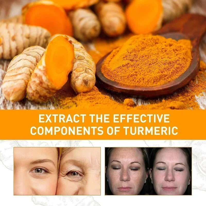 2pcs Turmeric Toner Lightening Skin Dark Corrector Moisturizing Face Serum Vitamin C Ginger Essence Korean Cosmetics Beauty
