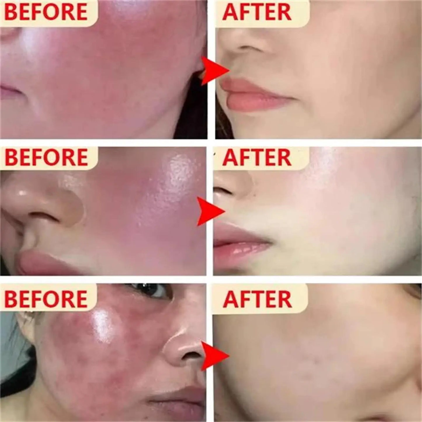 Facial Redness Repair Capsule Oil Improve Sensitive Skin Dryness Moisturizer Soothing Serum Removal Rosacea Korean Cosmetics